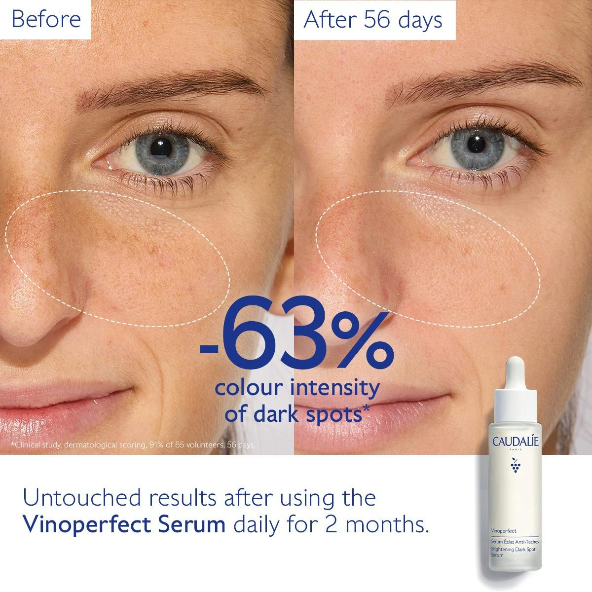 Vinoperfect Brightening Dark Spot Serum 50ml - Image 4