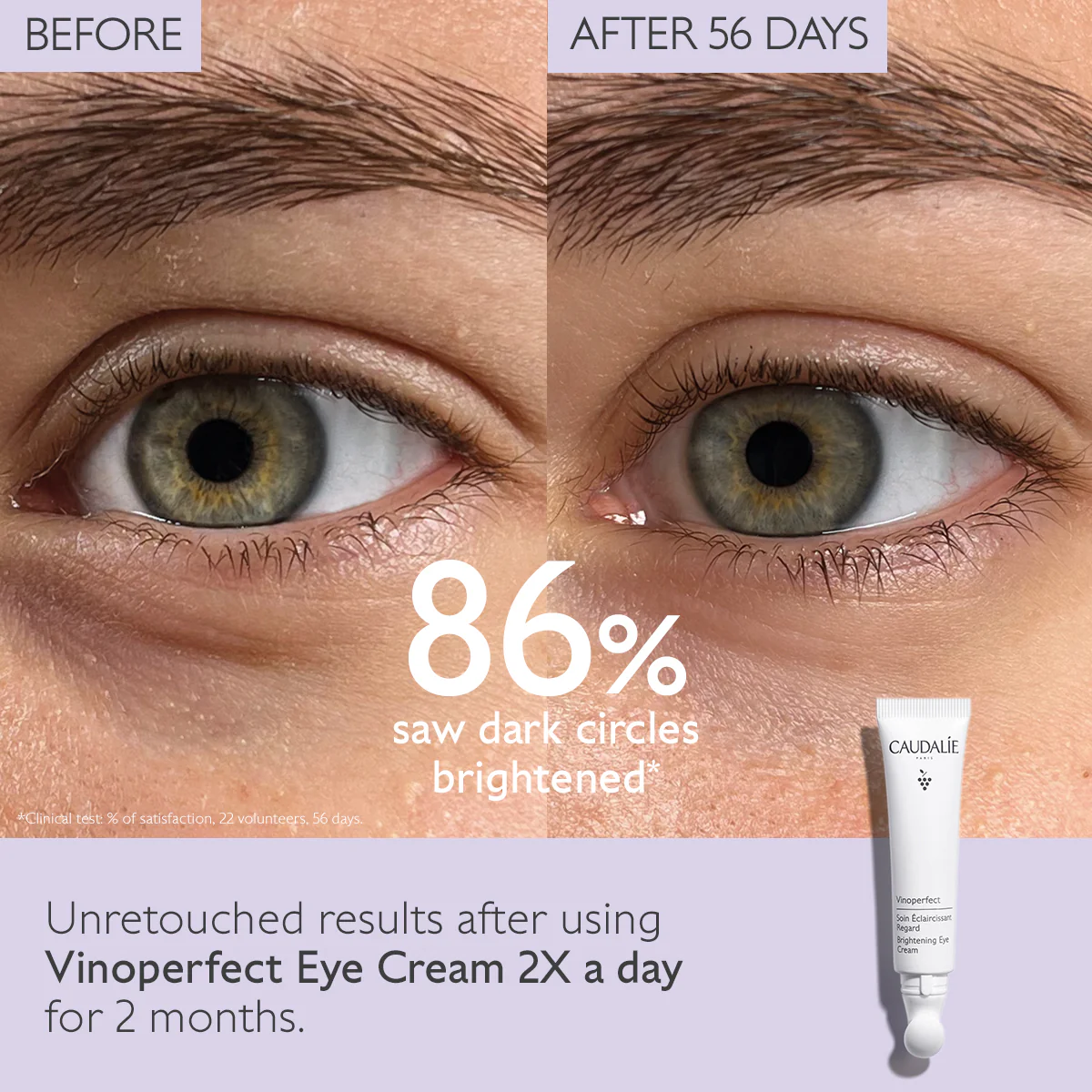 Vinoperfect Dark Circle Brightening Eye Cream With Niacinamide 15ml - Image 3