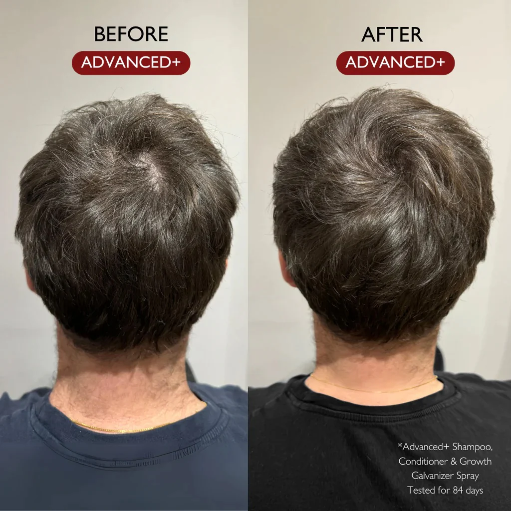 Advanced+ Conditioner 280ml - Image 3