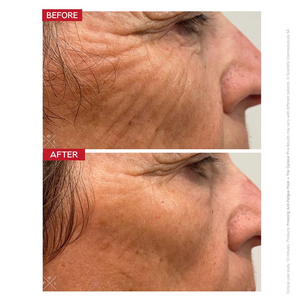 The Contour Pro - Image 3