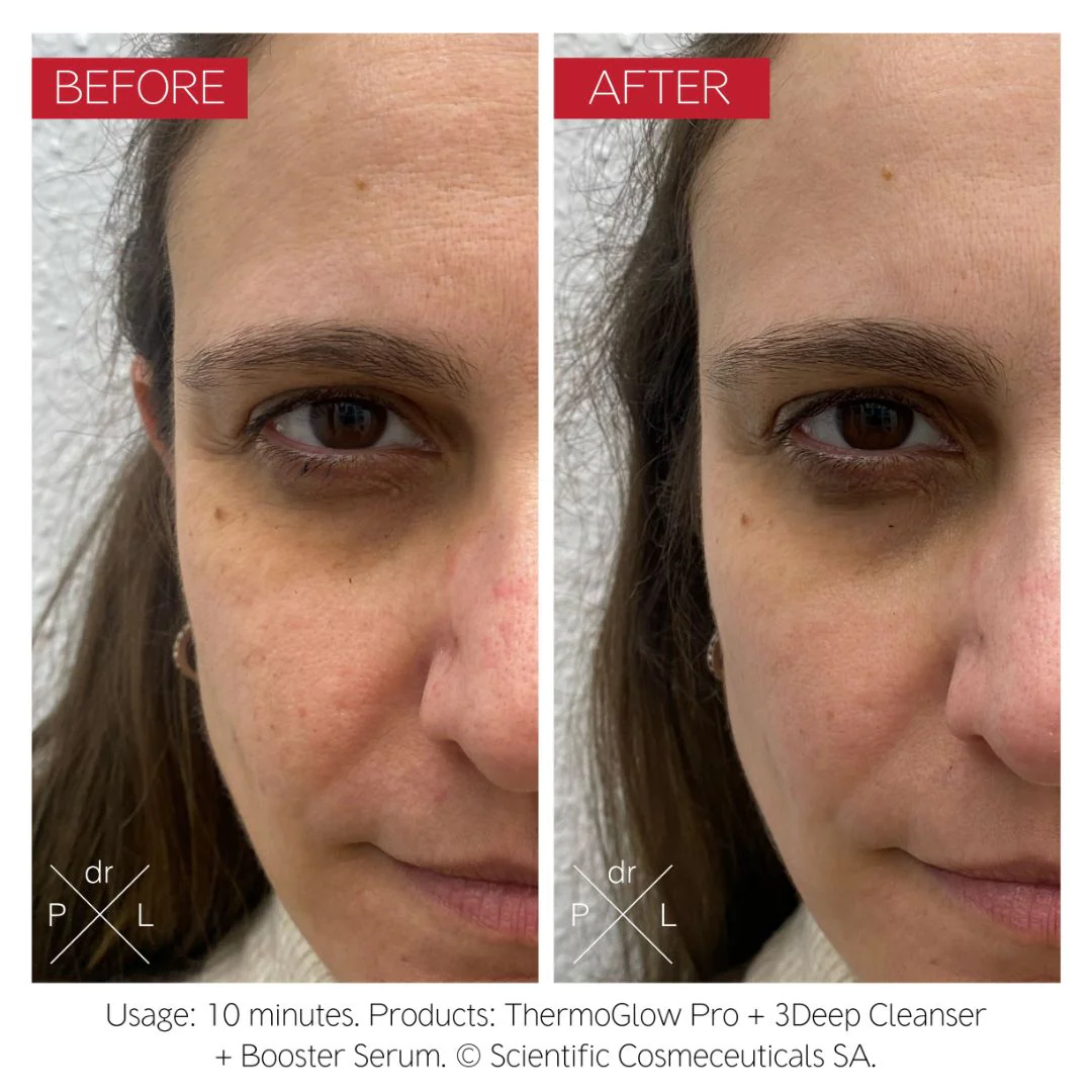 The Thermoglow Pro - Image 10