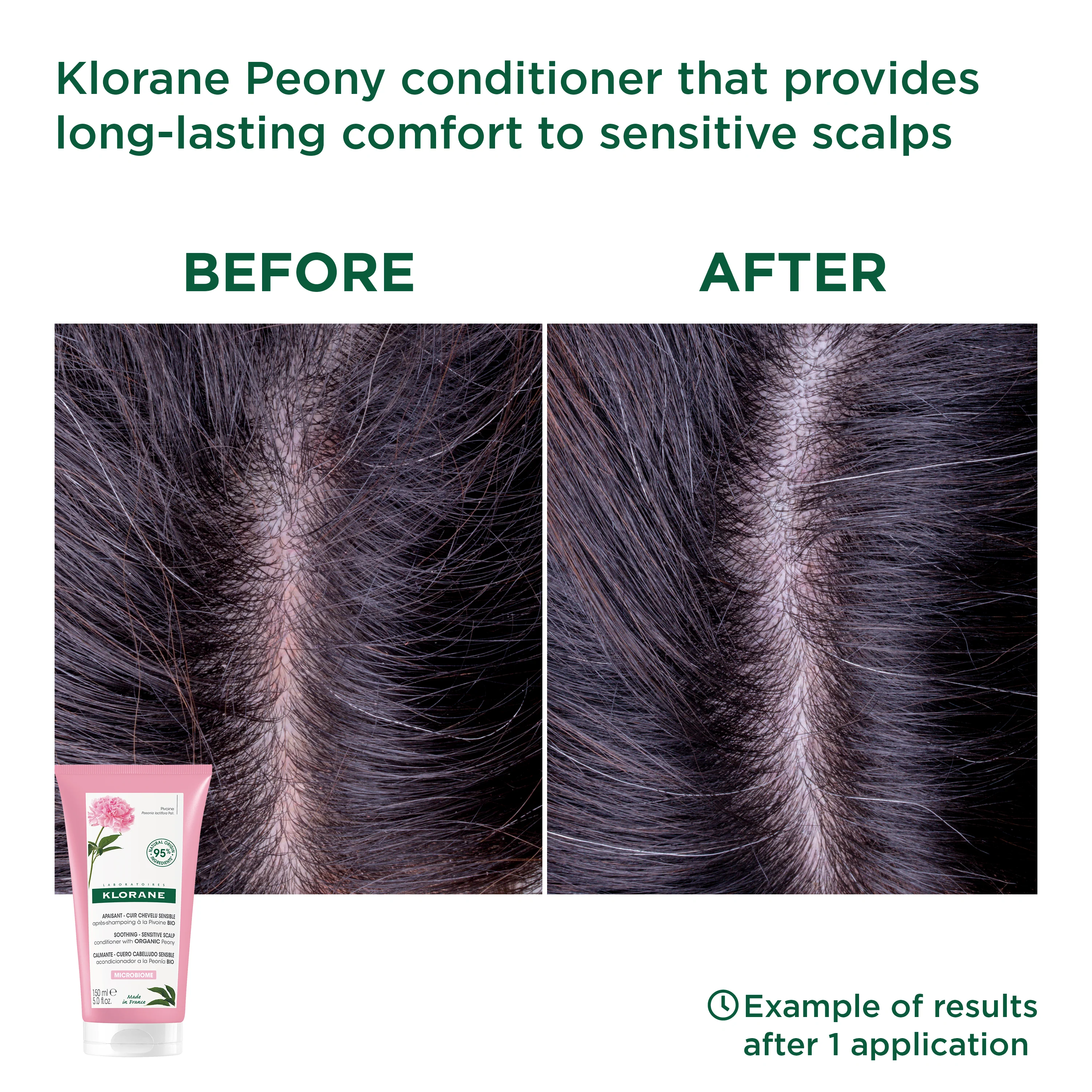 Peony Conditioner 150ml - Image 4
