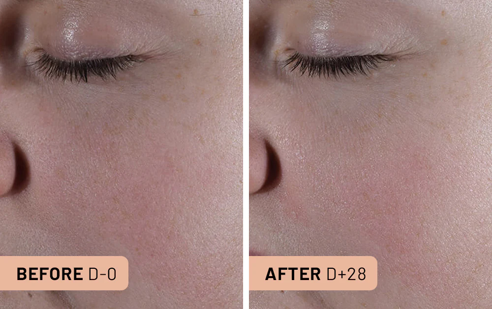 Brightening Serum 4 Capsules / 1 month - Image 4