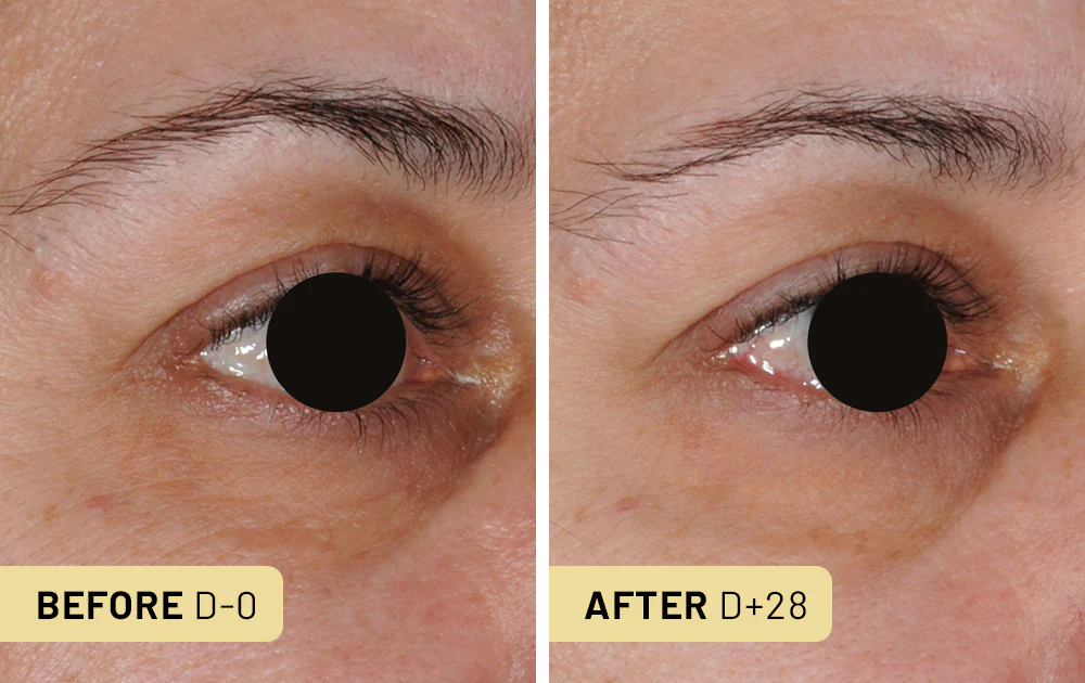 Eye Serum 4 Capsules / 1 month - Image 6