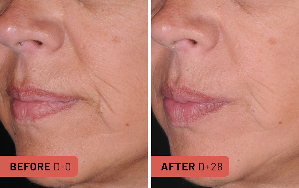 Lift Serum 4 Capsules / 1 Month - Image 5