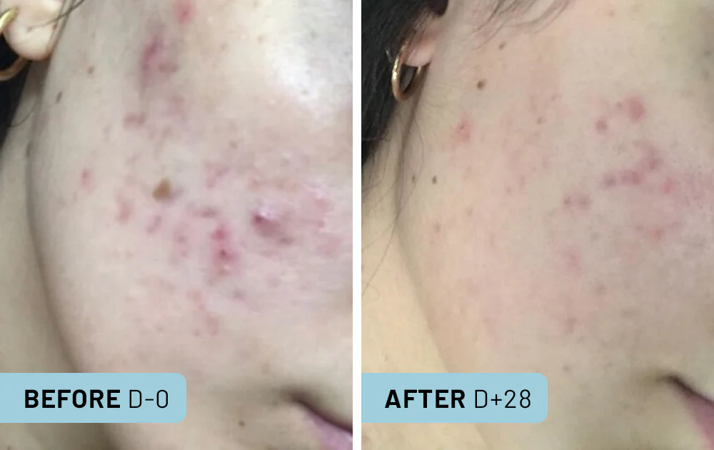 Purity Serum 4 Capsules / 1 month - Image 4