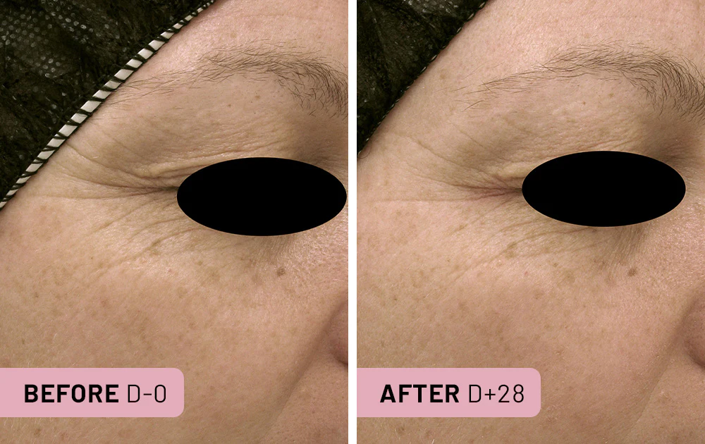 Repair Serum 4 Capsules / 1 month - Image 5