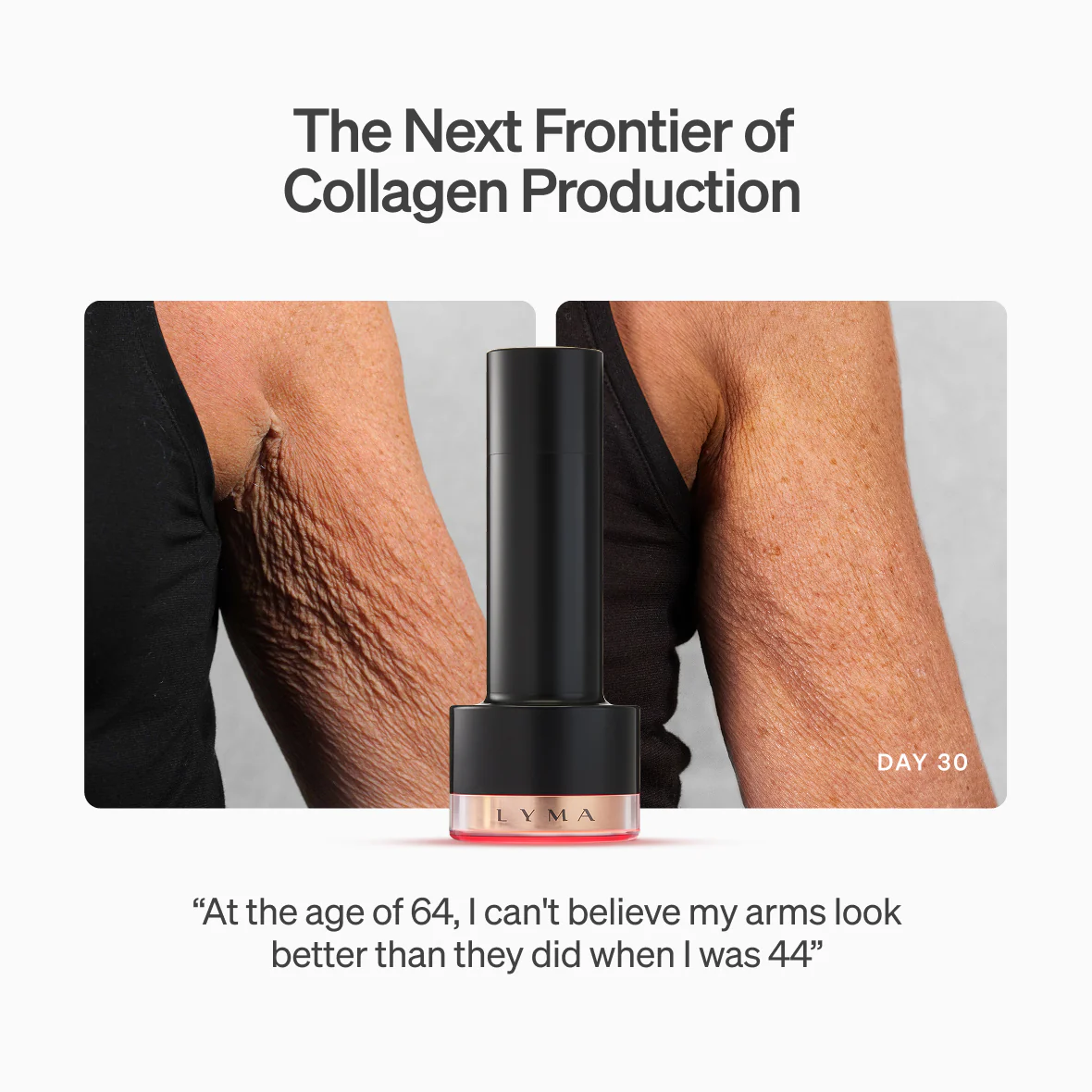 Laser PRO Starter Kit - Image 6