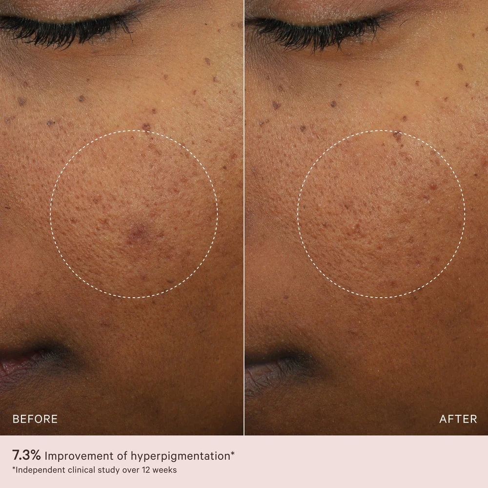 Micro-Peeling Glow Essence 100ml - Image 5