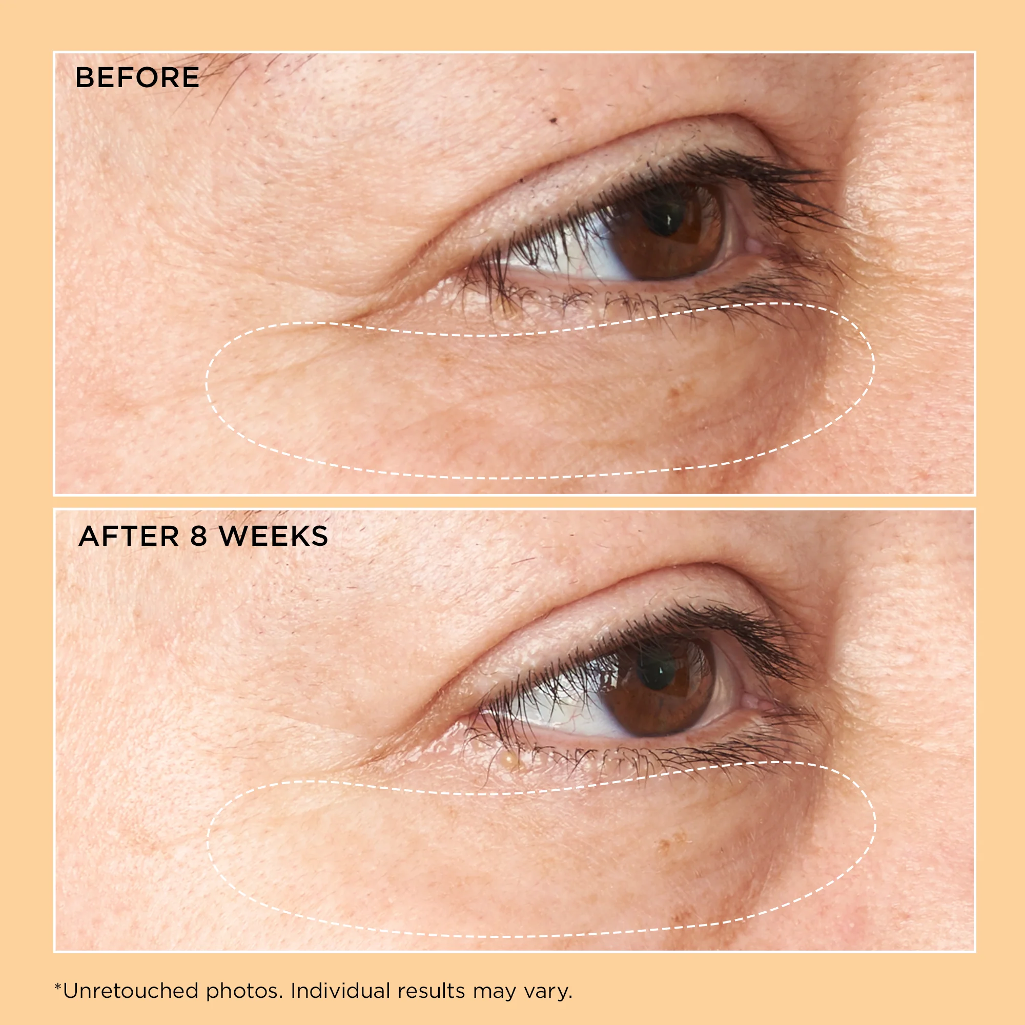 Neuropeptide Corrective Brightening Under-Eye Cream - Image 3