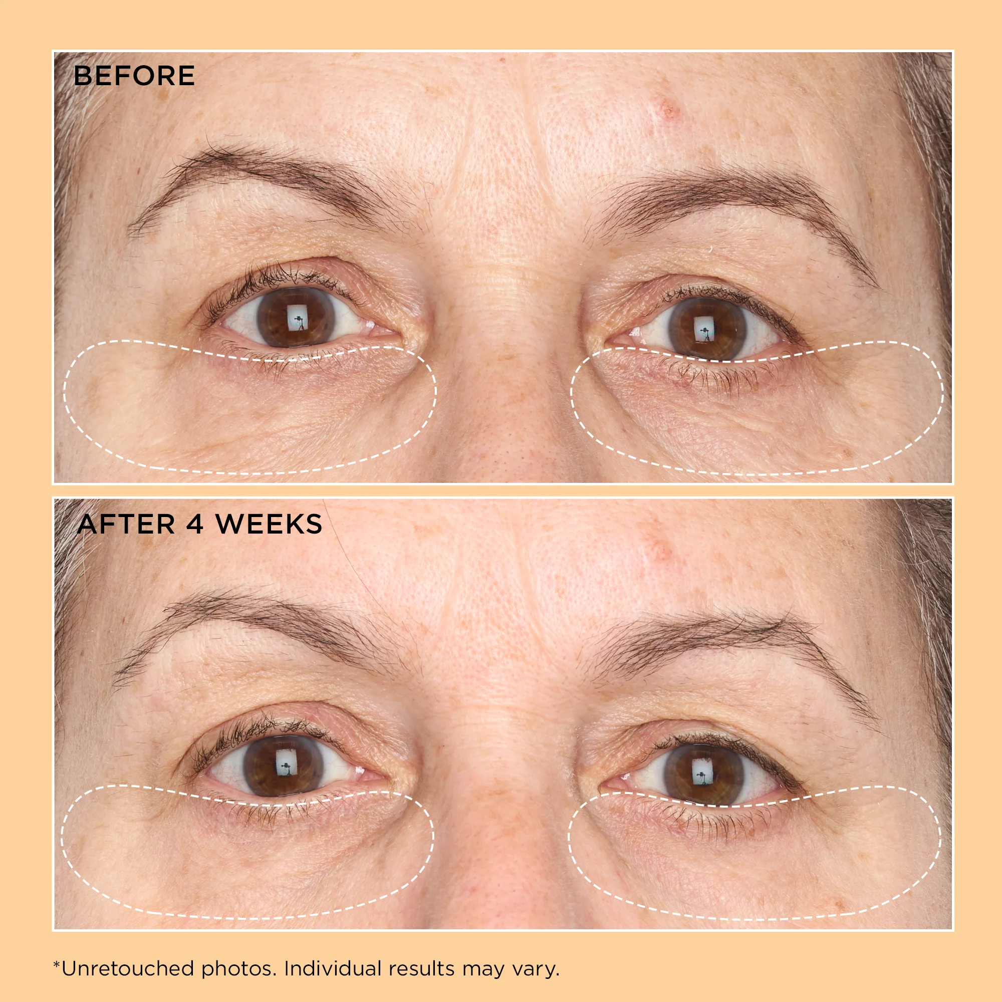 Neuropeptide Corrective Brightening Under-Eye Cream - Image 4