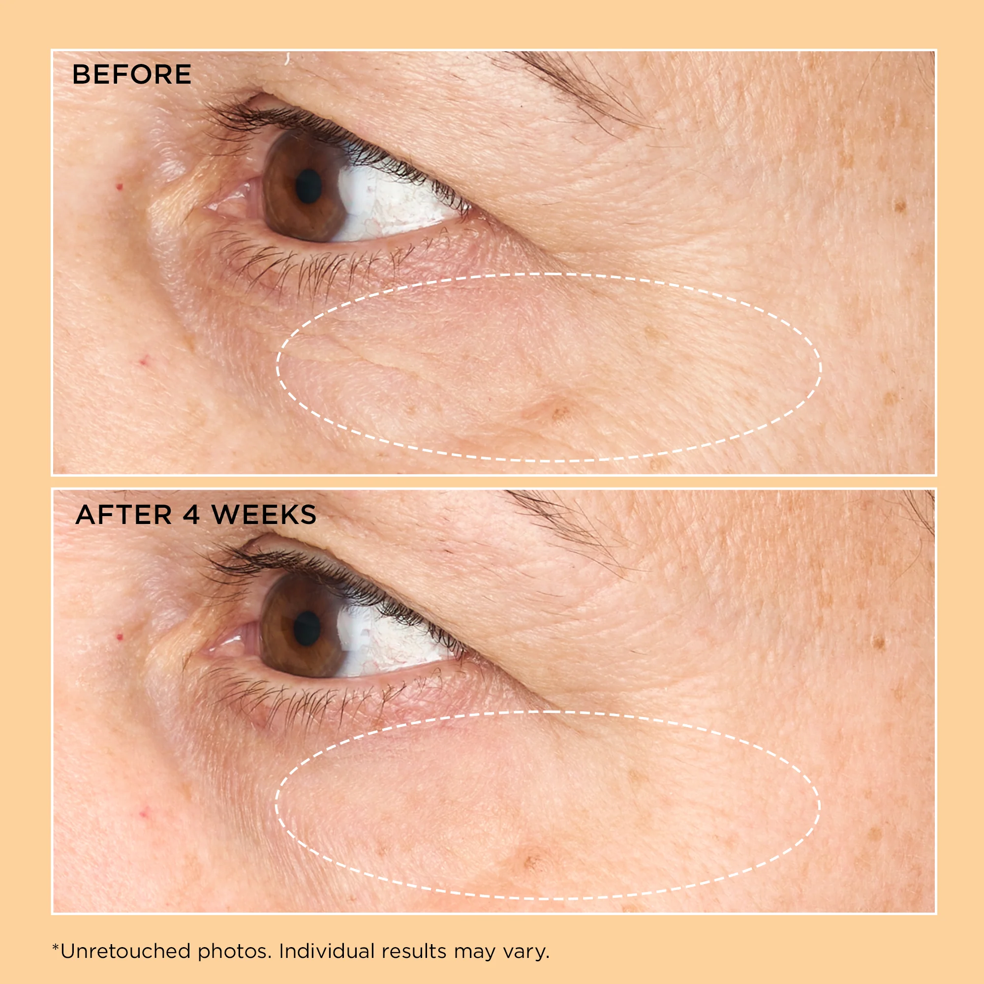 Neuropeptide Corrective Brightening Under-Eye Cream - Image 5