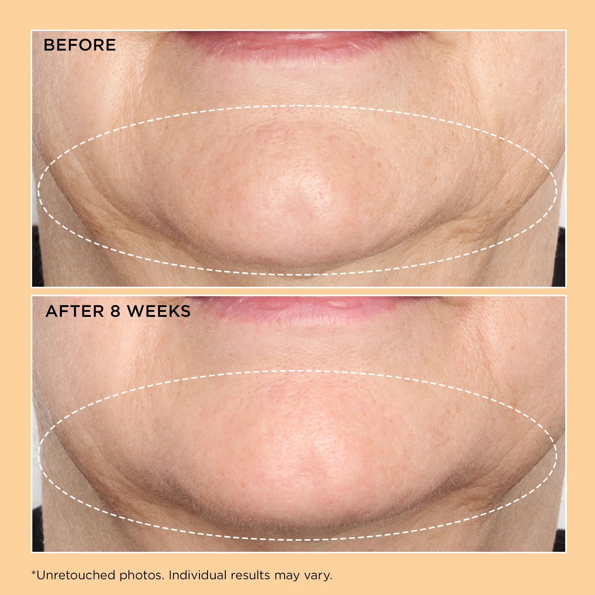 Neuropeptide Deep Crease Serum 30ml - Image 6