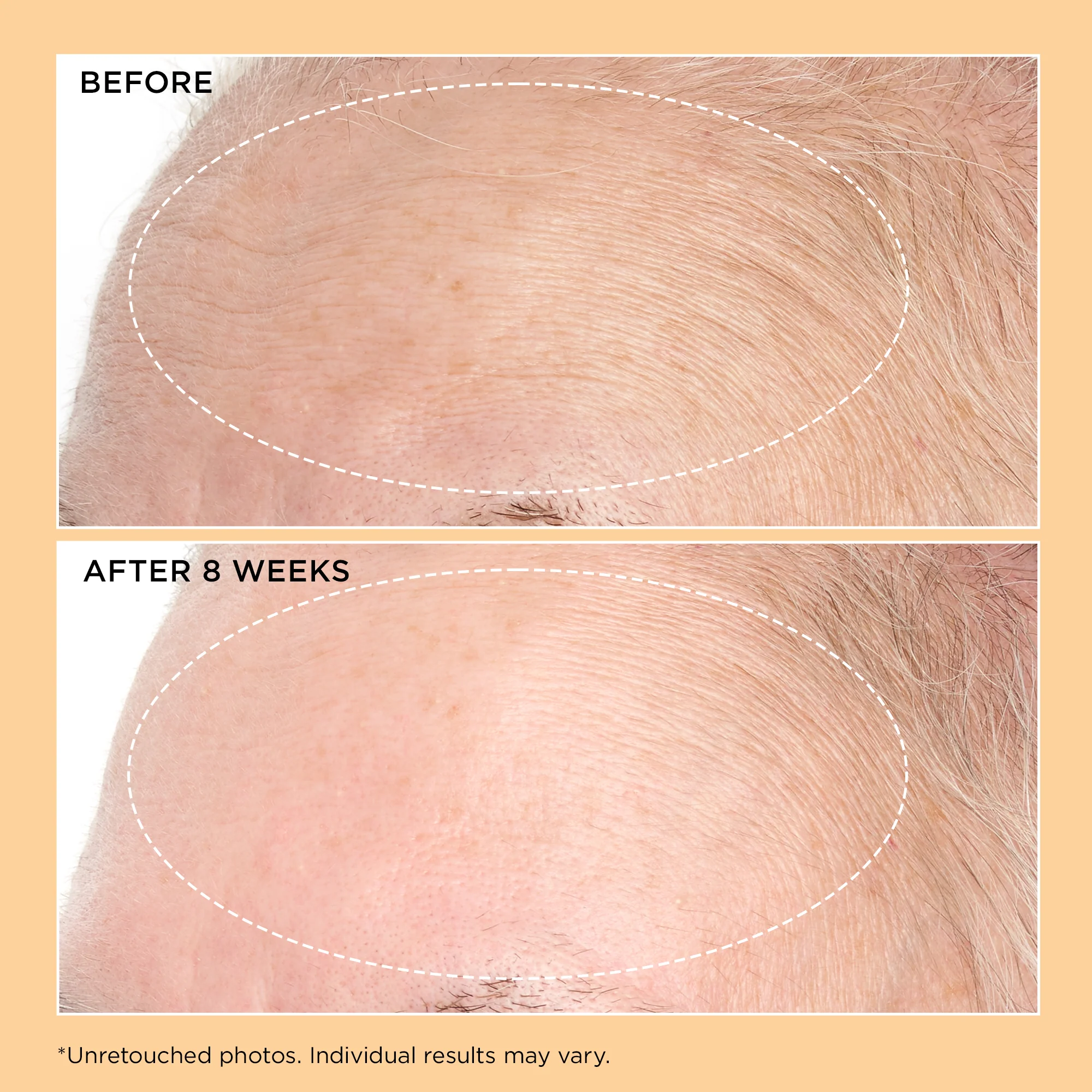 Neuropeptide Deep Crease Serum 30ml - Image 8
