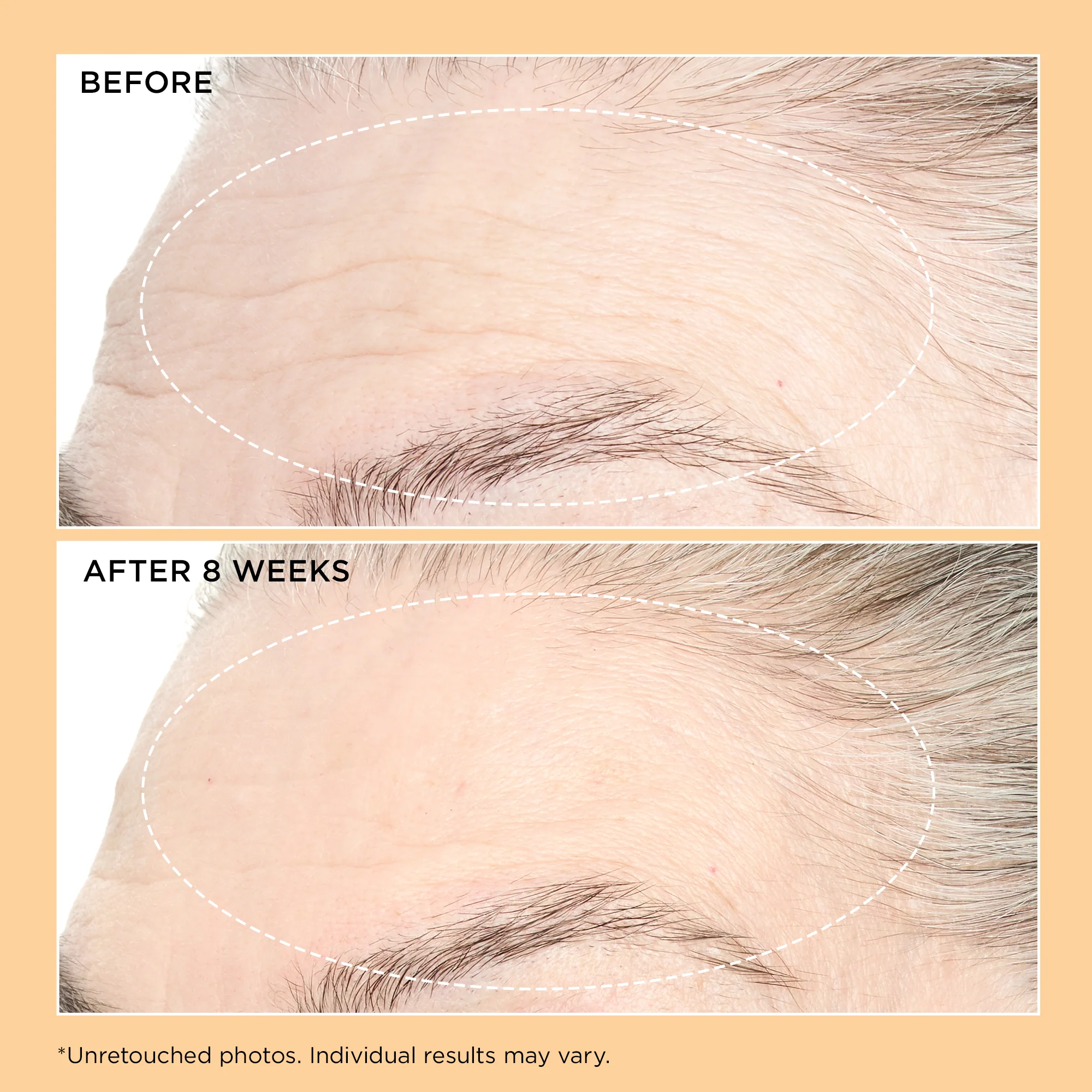 Neuropeptide Pro-Strength Firming Moisturizer - Image 3
