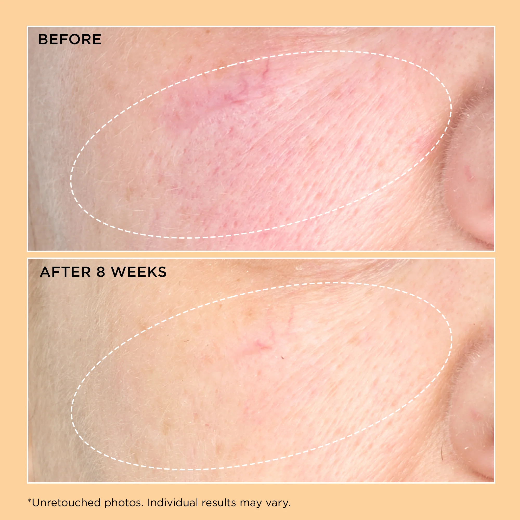 Neuropeptide Pro-Strength Firming Moisturizer - Image 4