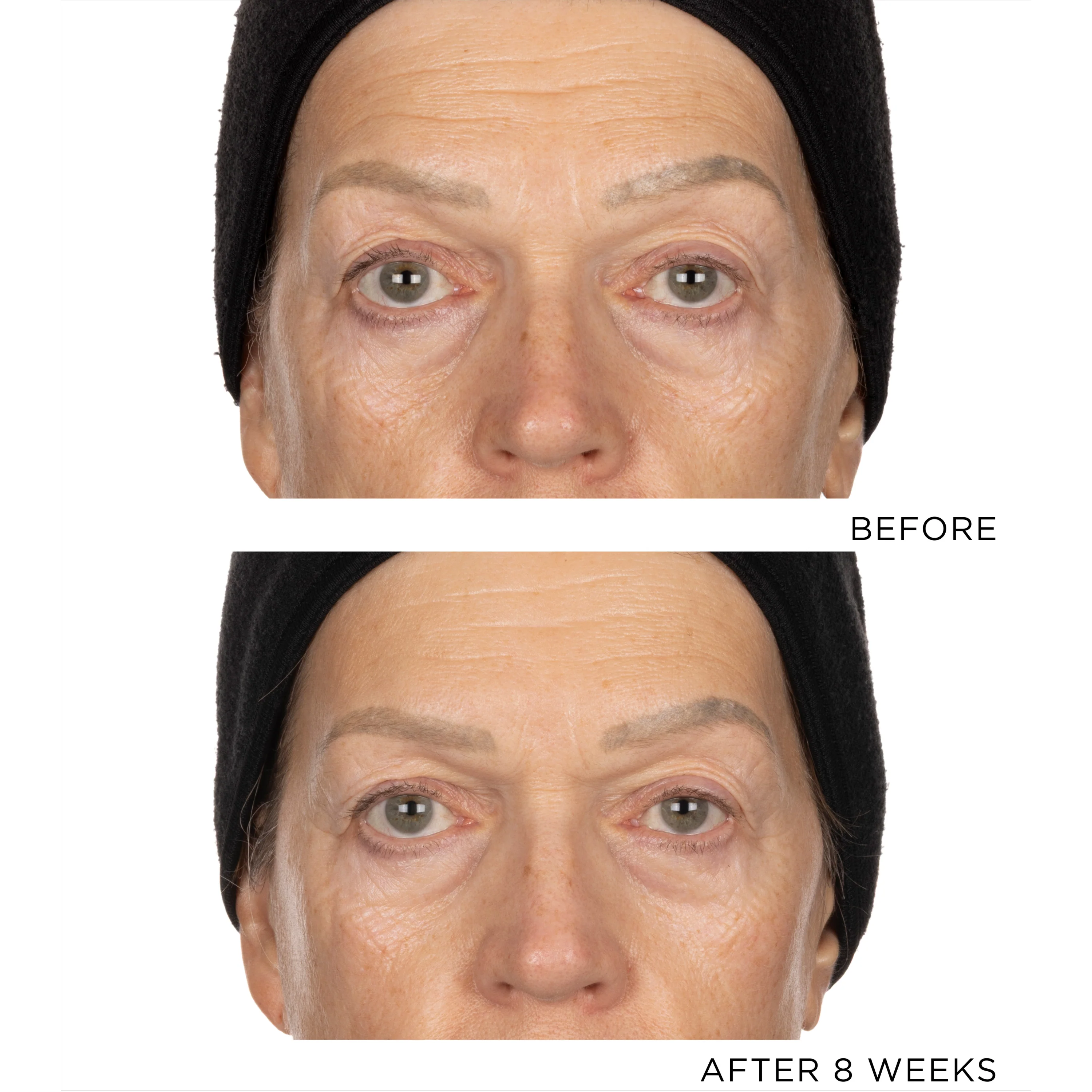 The Exceptional Repair Reset Cream 30 Dose - Image 3