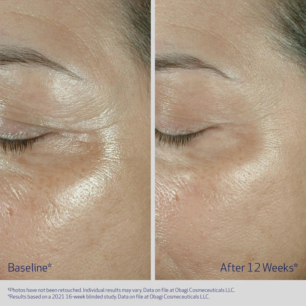 Elastiderm Eye Cream 15g - Image 2