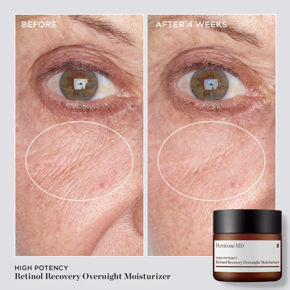 High Potency Retinol Recovery Overnight Moisturizer 59ml - Image 6