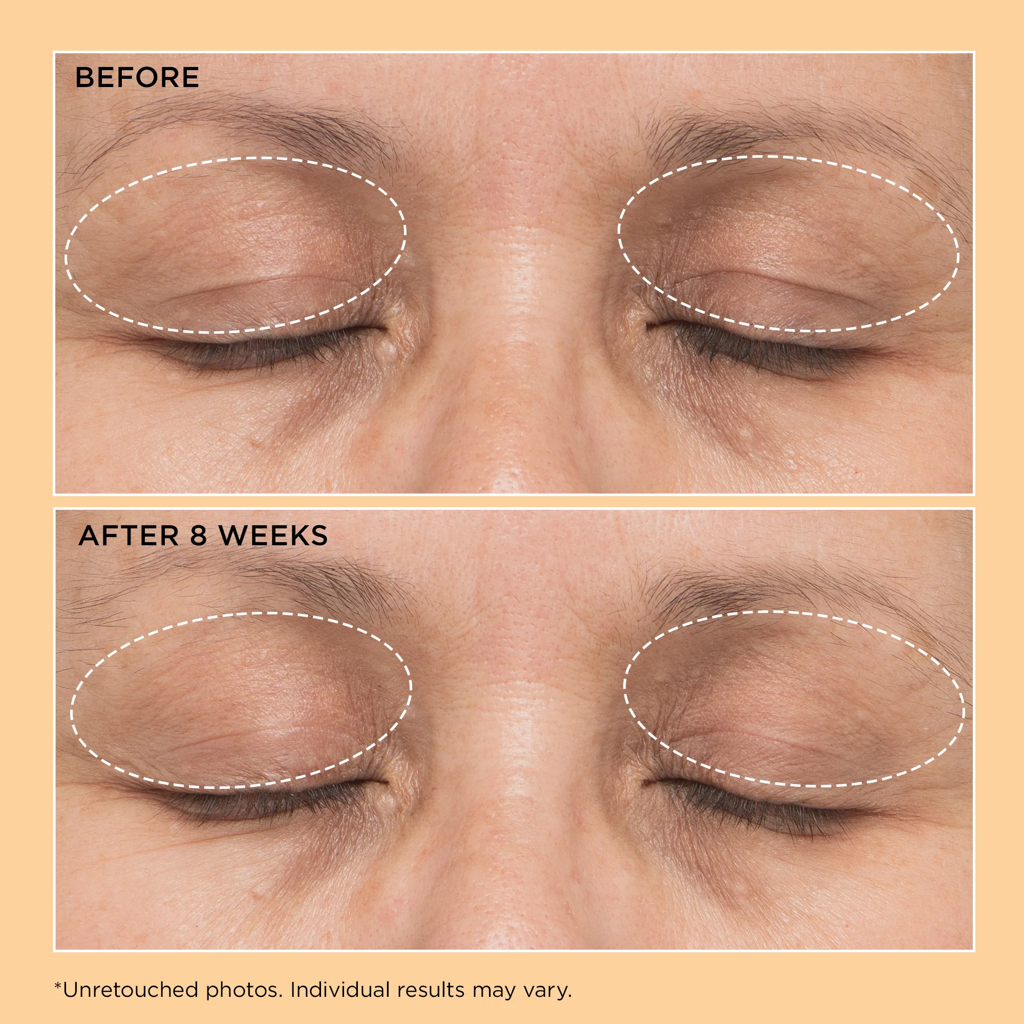 Neuropeptide Eyelid Lift Serum 15ml - Image 4