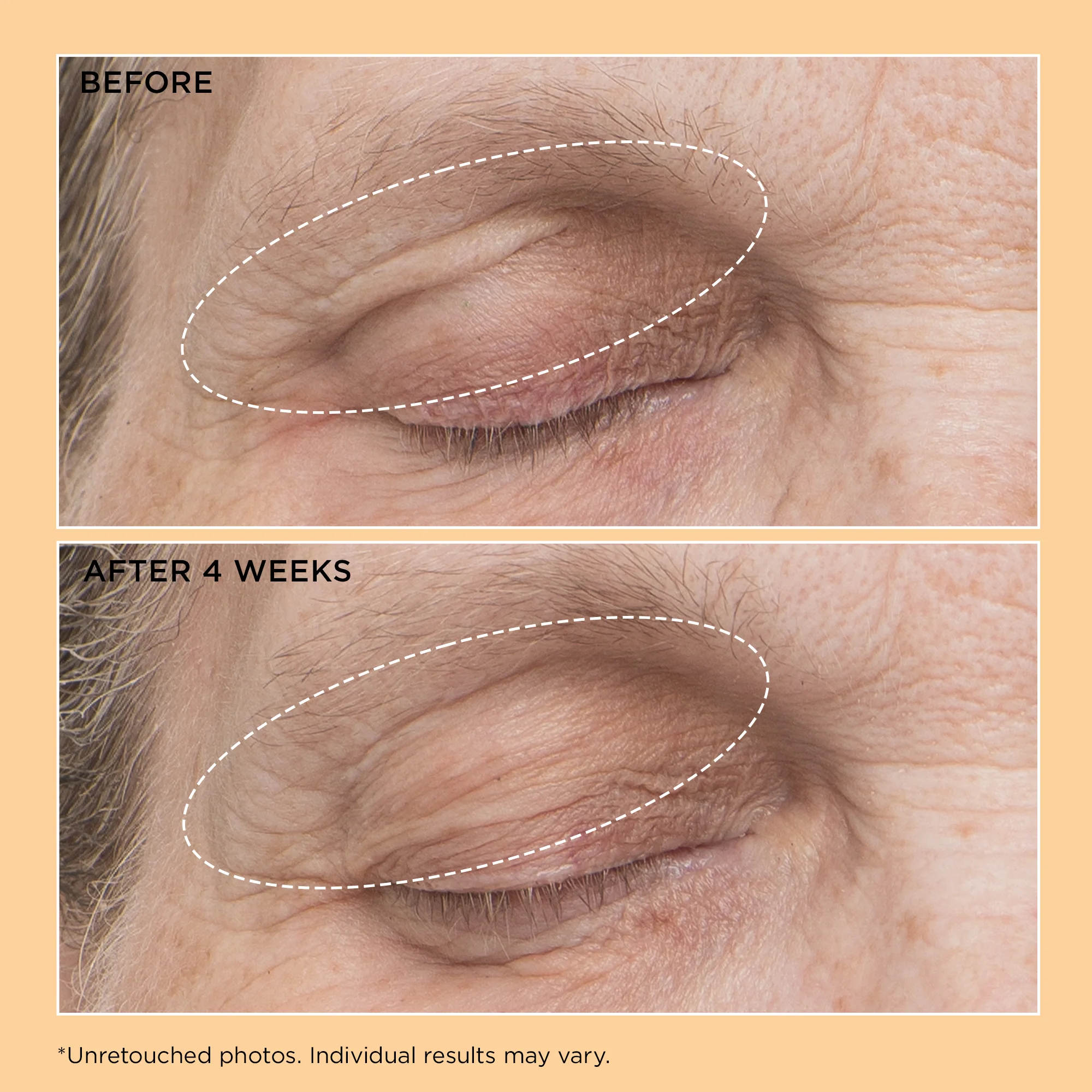 Neuropeptide Eyelid Lift Serum 15ml - Image 5