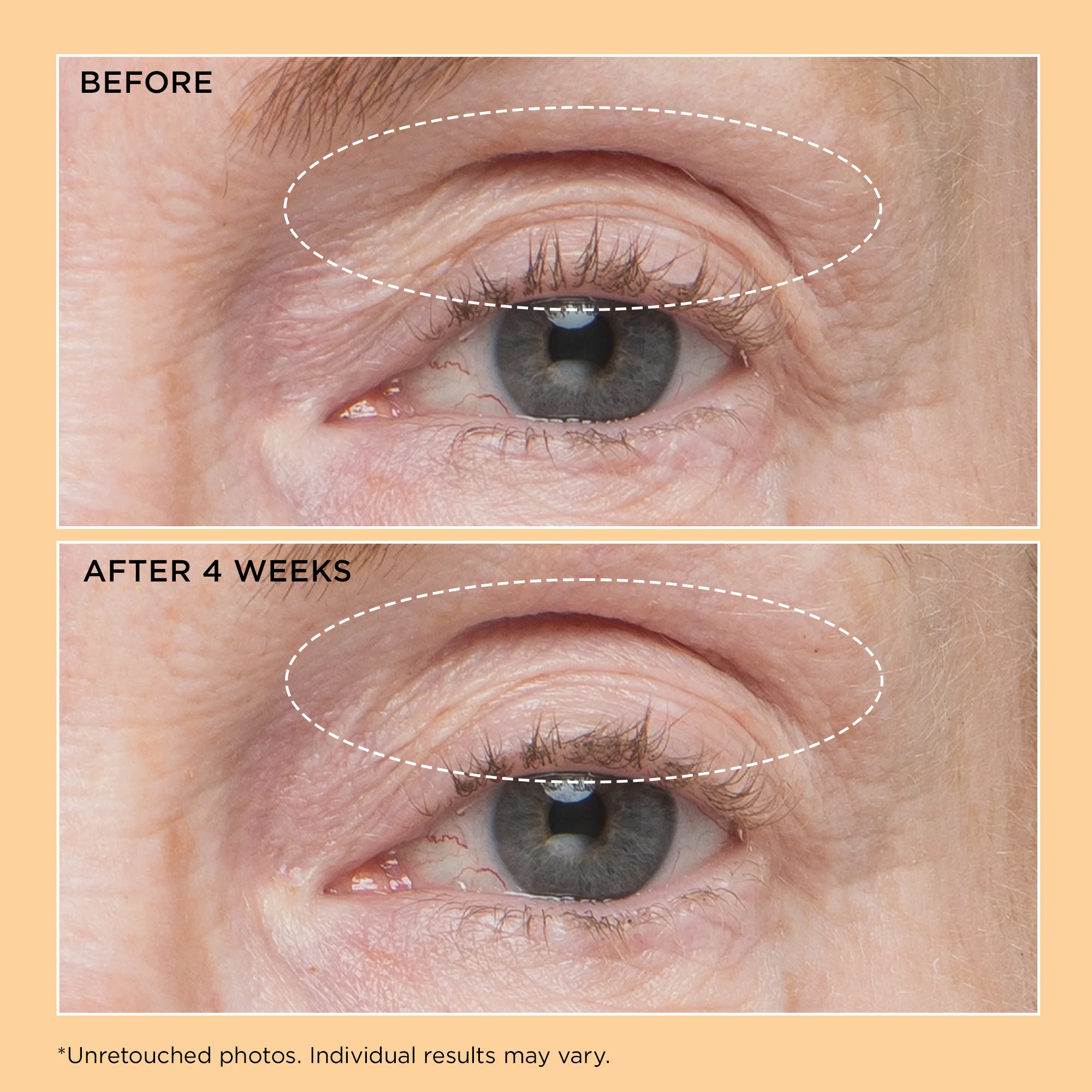 Neuropeptide Eyelid Lift Serum 15ml - Image 6
