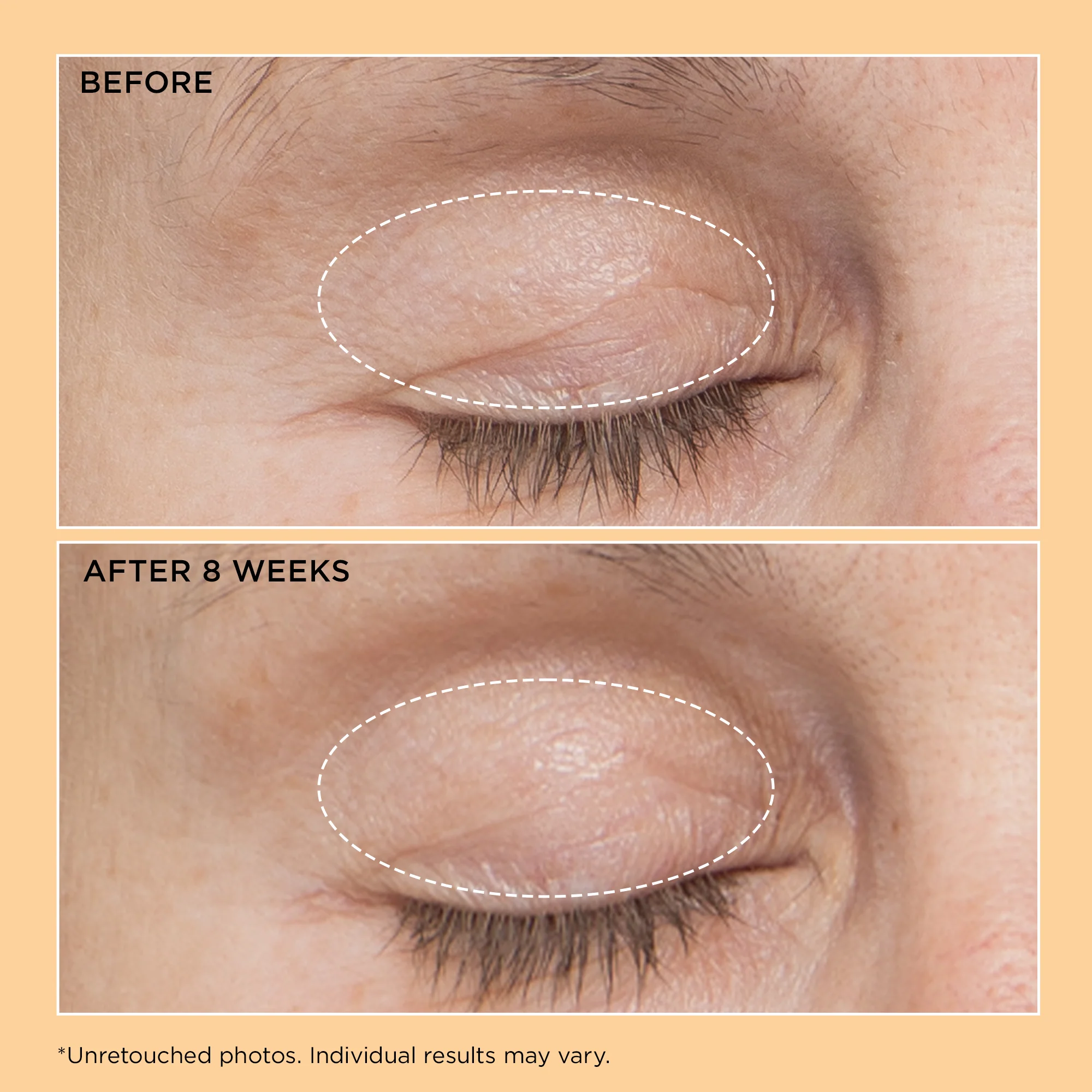 Neuropeptide Eyelid Lift Serum 15ml - Image 7