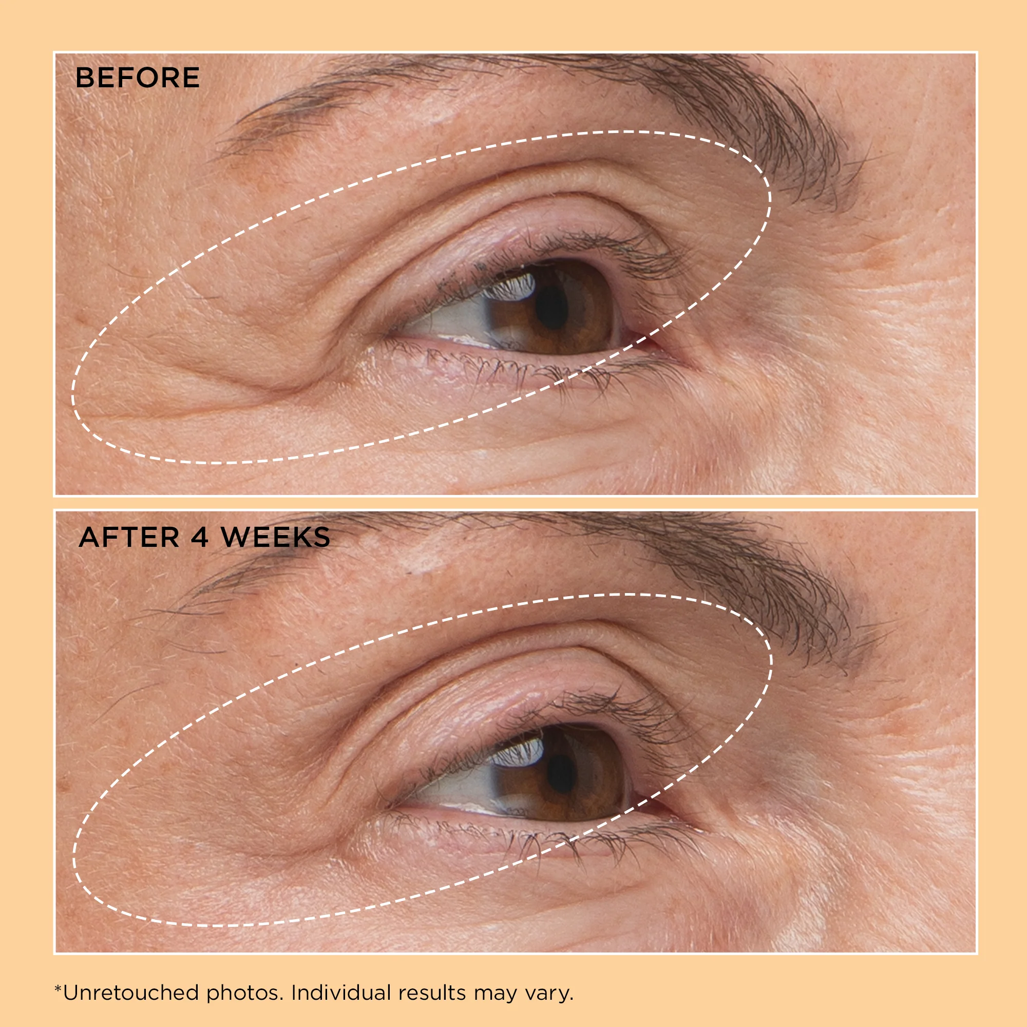 Neuropeptide Eyelid Lift Serum 15ml - Image 8