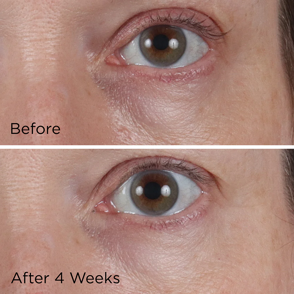 Vitamin C Ester Ccc + Ferulic Brightening Under-Eye Cream 15ml - Image 3