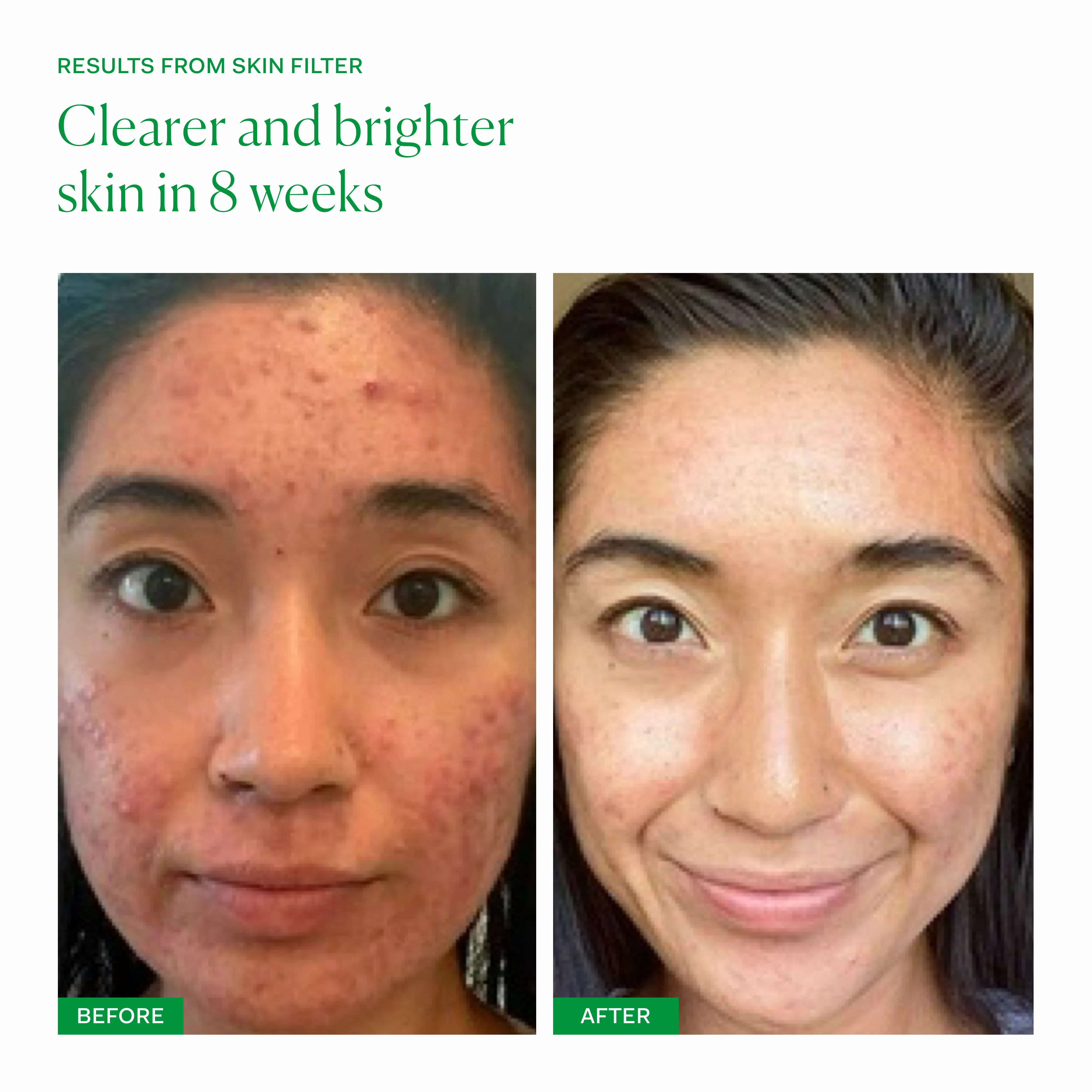 Skin Filter 30 capsules - Image 5