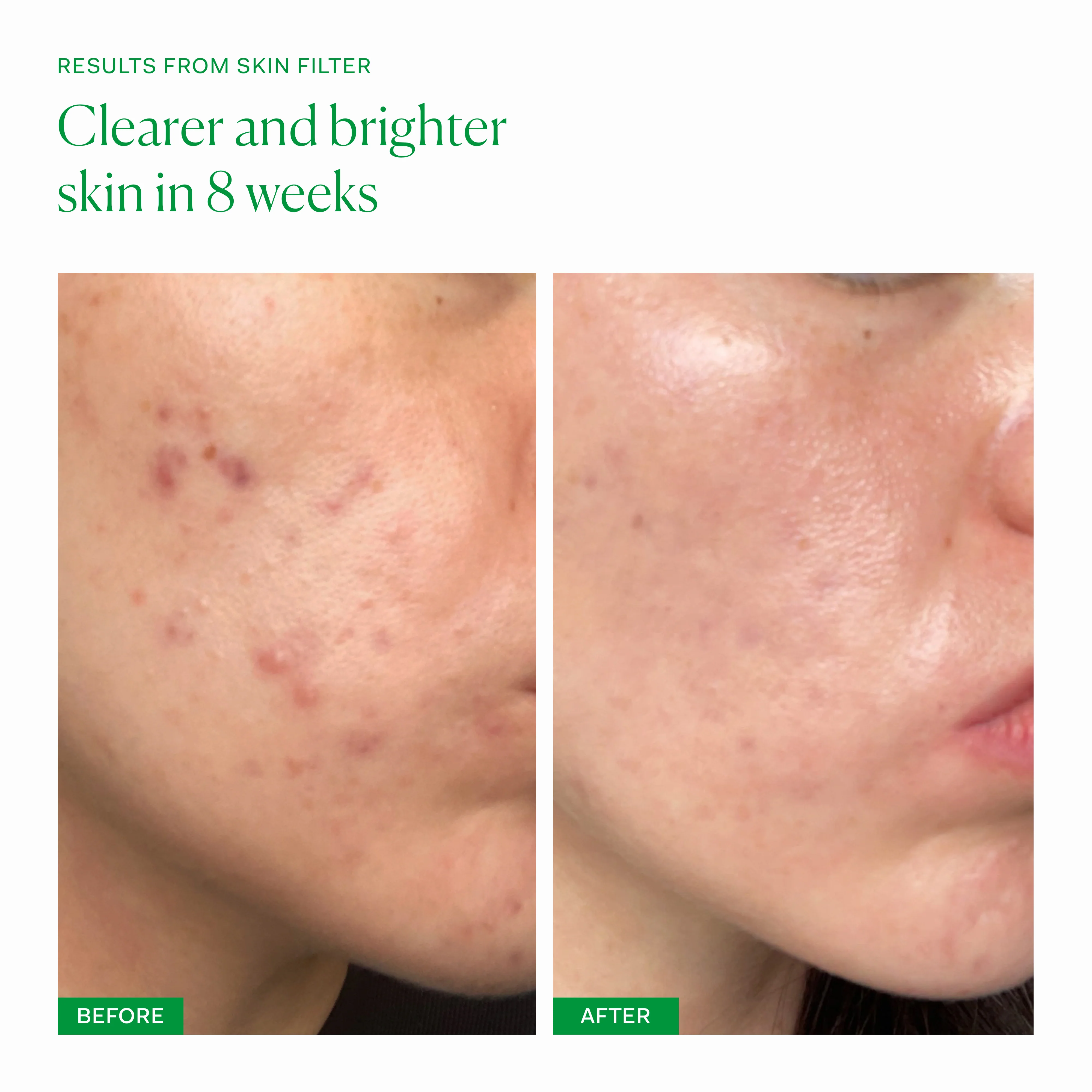 Skin Filter 30 capsules - Image 6