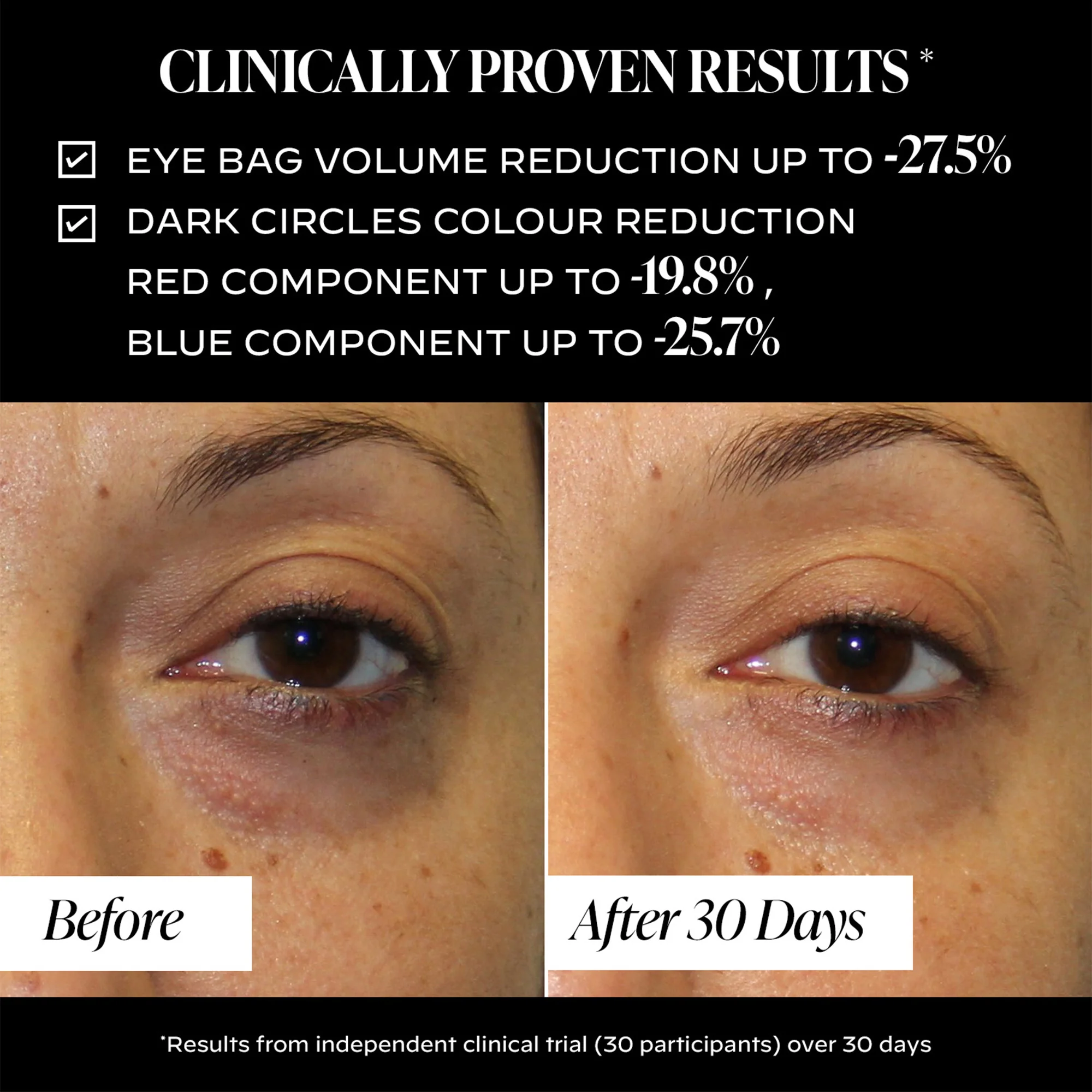 Triple Action Eye Cream 15ml - Image 5